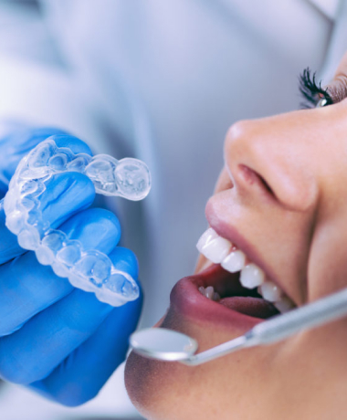Clareamento Dental Caseiro e à Laser| Consultório Odontológico em Vitória – ES
