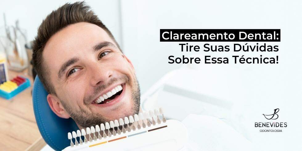 Clareamento Dental: Tire Suas Dúvidas Sobre Essa Técnica!