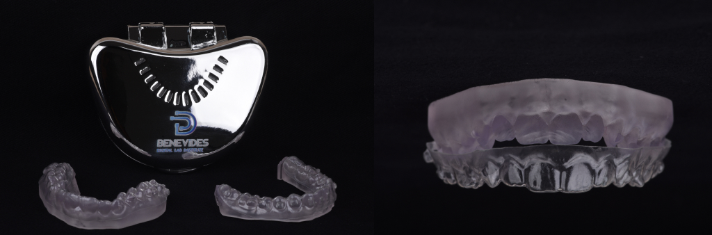 confeccao-de-alinhadores-ortodonticos-invisalign