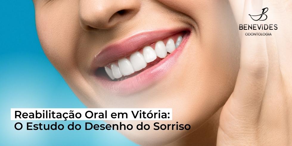 Reabilitação Oral em Vitória: O Estudo do Desenho do Sorriso