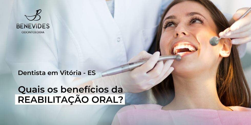Dentista em Vitória – ES | Quais os benefícios da reabilitação oral?