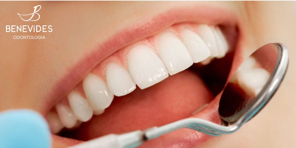 Canal dentário: Cuidados necessários após o tratamento