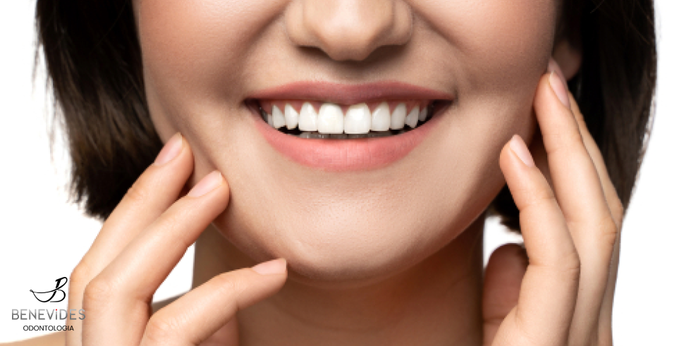 Transforme seu Sorriso com Reabilitação Estética em Resina