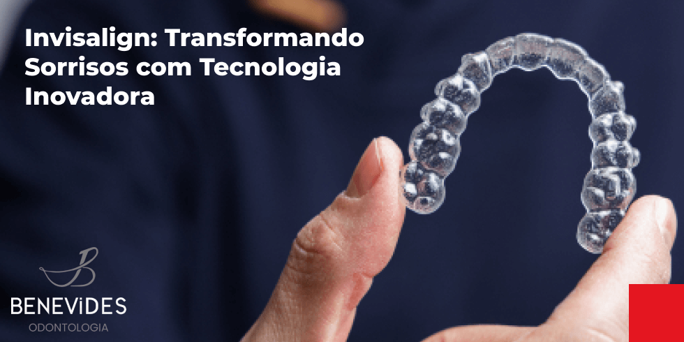 Invisalign: Transformando Sorrisos com Tecnologia Inovadora