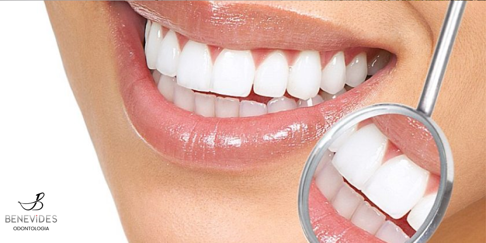 Dentística Restauradora: Técnicas Que Melhoram a Função e a Estética

