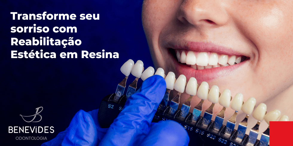 Transforme seu Sorriso com Reabilitação Estética em Resina