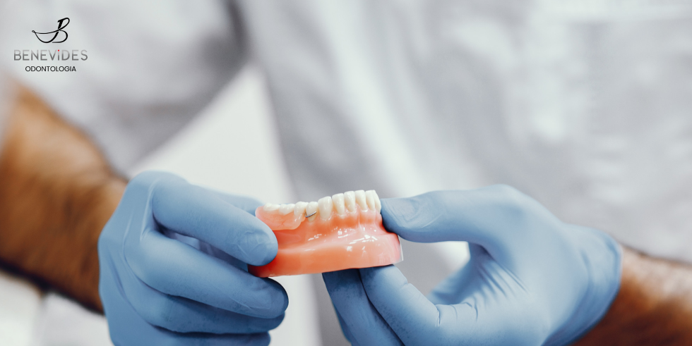 Prótese Dentária Protocolo: A Excelência da Dentadura Fixa
