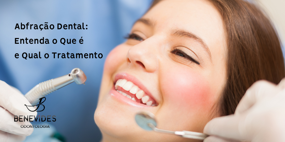 Abfração Dental: Entenda o Que é e Qual o Tratamento