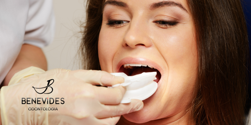 Procedimentos de Odontologia Estética Para Começar o Ano!
