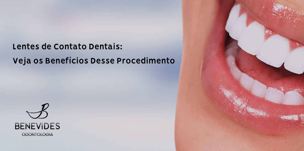 Lentes de Contato Dentais: Veja os Benefícios Desse Procedimento