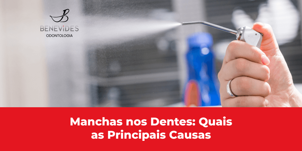 Manchas nos Dentes: Quais as Principais Causas