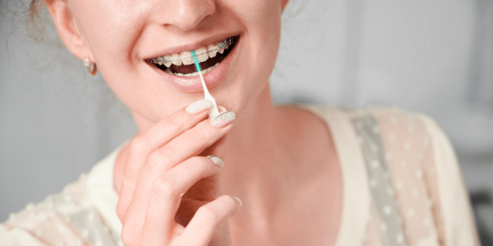 Cuidados com os Dentes Durante o Uso de Aparelho Ortodôntico
