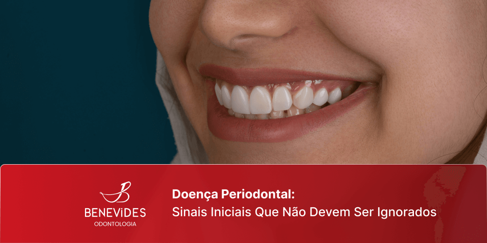Doença Periodontal: Sinais Iniciais Que Não Devem Ser Ignorados