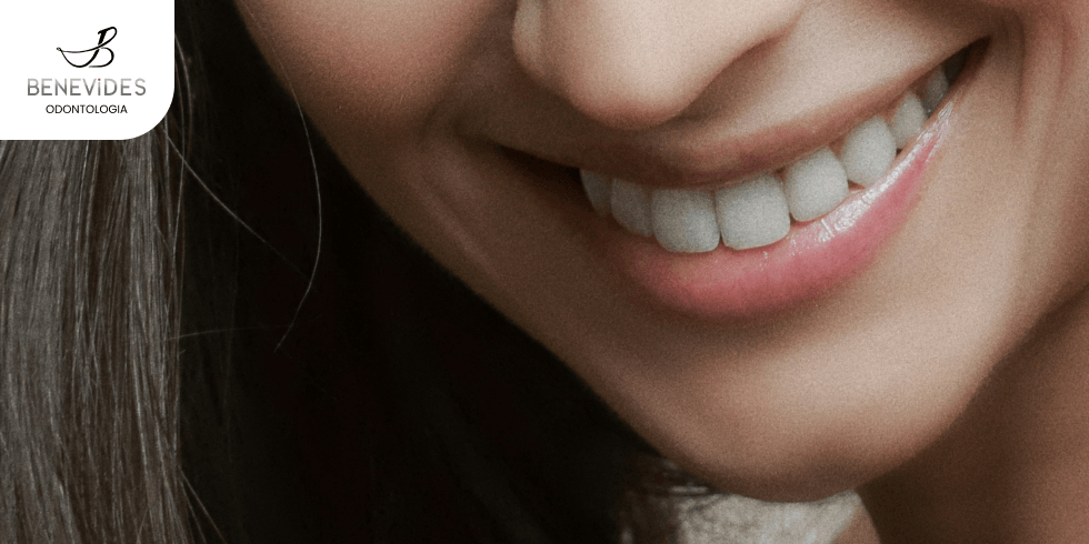Doença Periodontal: Sinais Iniciais Que Não Devem Ser Ignorados | Dr. Jefferson Benevides Ortodontia e Ortopedia Facial no ES Doença Periodontal: Sinais Iniciais Que Não Devem Ser Ignorados | Dr. Jefferson Benevides Ortodontia e Ortopedia Facial no ES