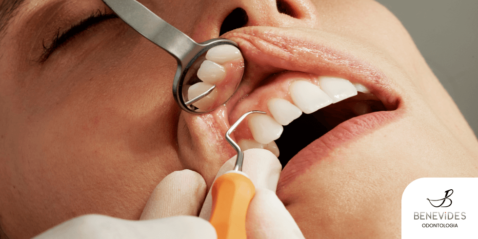 Doença Periodontal: Sinais Iniciais Que Não Devem Ser Ignorados | Dr. Jefferson Benevides Ortodontia e Ortopedia Facial no ES Qual o tratamento odontológico para periodontite?
