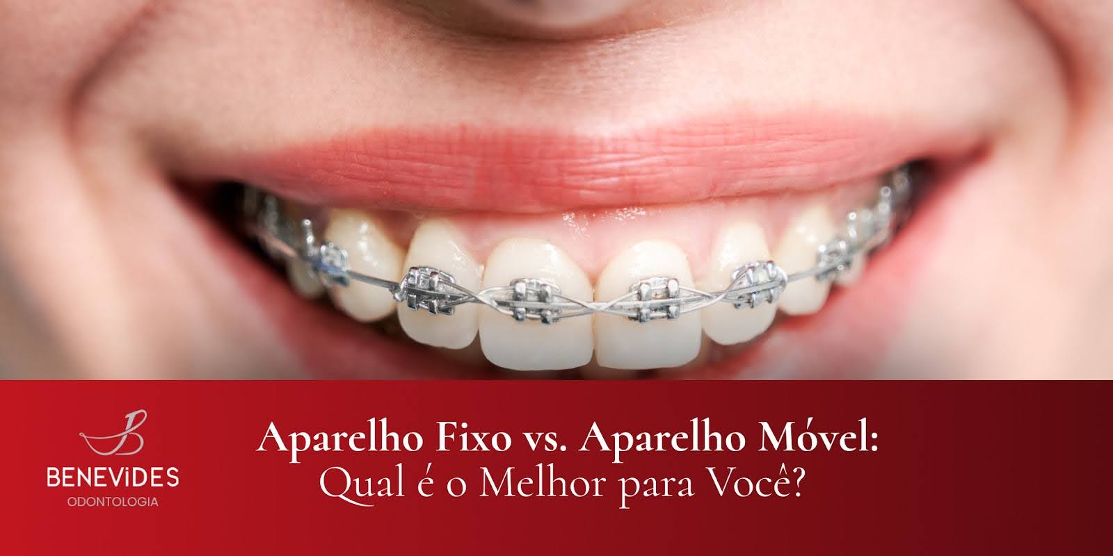 Aparelho Fixo vs. Aparelho Móvel: Qual é o Melhor para Você?