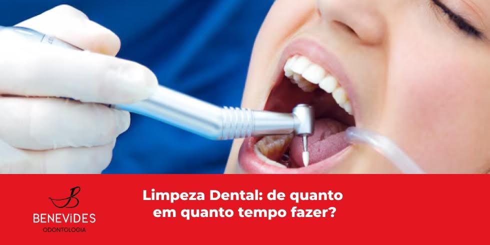 Limpeza dental: de quanto em quanto tempo fazer?